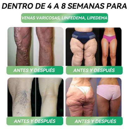 𝐓𝐢𝐞𝐧𝐝𝐚 𝐎𝐟𝐢𝐜𝐢𝐚𝐥 | 𝐇𝑯𝐕𝐁® 👩‍⚕️ 𝑮𝙇𝙋-𝟏 𝐒𝐨𝐥𝐮𝐜𝐢ó𝐧 𝐎𝐫𝐚𝐥 𝟔-𝐞𝐧-𝟏 (𝟏 𝐝𝐨𝐬𝐢𝐬 𝐚𝐥 𝐝í𝐚, 𝐜𝐚𝐦𝐛𝐢𝐨𝐬 𝐯𝐢𝐬𝐢𝐛𝐥𝐞𝐬 𝐞𝐧 𝟕 𝐝í𝐚𝐬) ✅ 𝐏𝐮𝐞𝐝𝐞 𝐚𝐲𝐮𝐝𝐚𝐫 𝐜𝐨𝐧 𝐨𝐛𝐞𝐬𝐢𝐝𝐚𝐝, 𝐬𝐚𝐥𝐮𝐝 𝐜𝐚𝐫𝐝𝐢𝐨𝐯𝐚𝐬𝐜𝐮𝐥𝐚𝐫, 𝐜𝐨𝐧𝐭𝐫𝐨𝐥 𝐝𝐞 𝐥𝐚 𝐝𝐢𝐚𝐛𝐞𝐭𝐞𝐬, 𝐚𝐩𝐧𝐞𝐚 𝐝𝐞𝐥 𝐬𝐮𝐞ñ𝐨, 𝐬𝐚𝐥𝐮𝐝 𝐚𝐫𝐭𝐢𝐜𝐮𝐥𝐚𝐫 𝐲 𝐦á𝐬